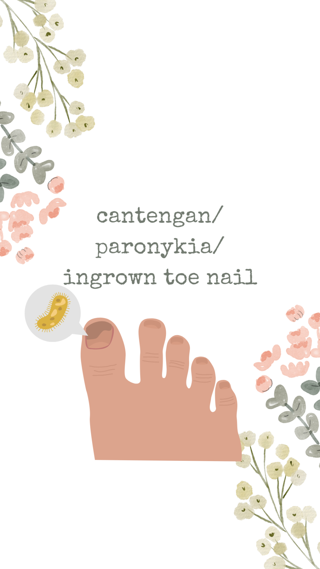Ingrown toe nail / paronikia/Cantengan